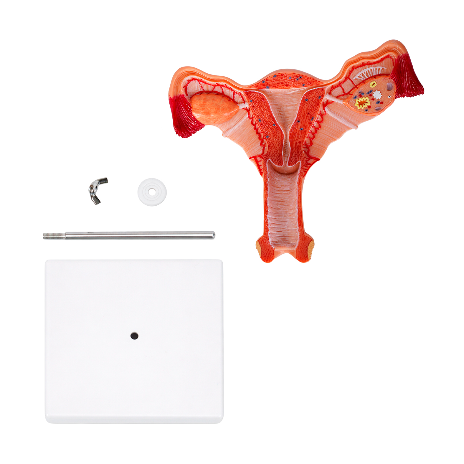 Modelo Utero - Imagen 3